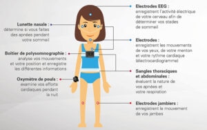 Diagnostic_polysomnographie